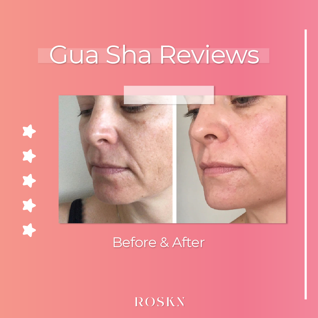 Gua-Sha | جواشا